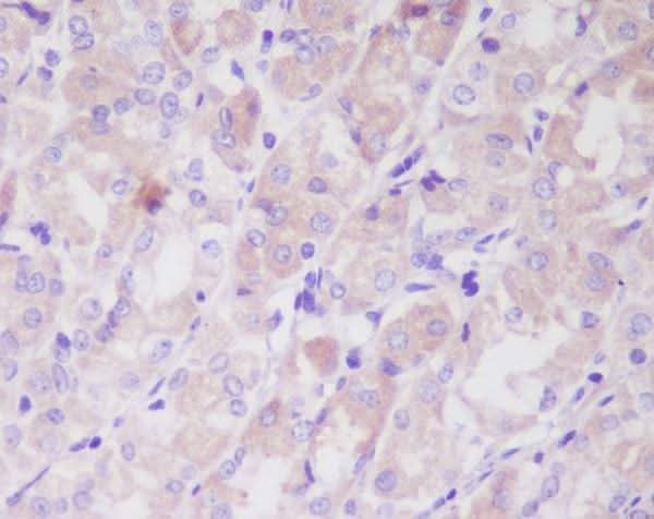 Anti-ILK/Integrin Linked Ilk Rabbit Monoclonal Antibody Boster Bio