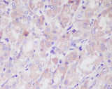 Anti-ILK/Integrin Linked Ilk Rabbit Monoclonal Antibody Boster Bio