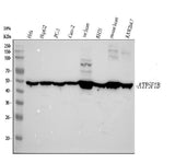 Anti-ATPB Rabbit Monoclonal Antibody Boster Bio