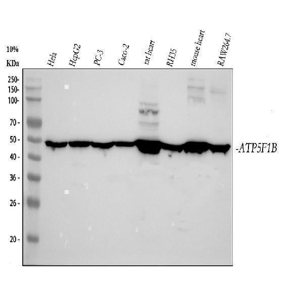 Anti-ATPB Rabbit Monoclonal Antibody Boster Bio