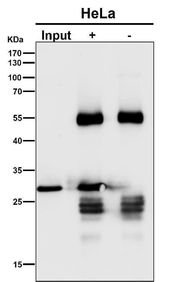 Anti-GCLM Rabbit Monoclonal Antibody Boster Bio