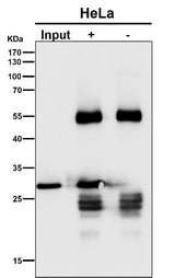 Anti-GCLM Rabbit Monoclonal Antibody Boster Bio