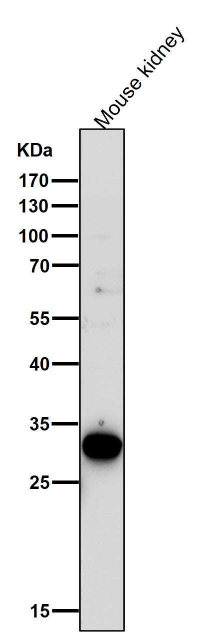 Anti-GCLM Monoclonal Antibody Boster Bio