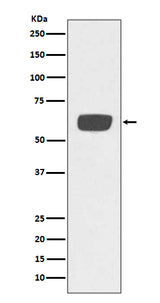 Anti-PLAT/Tpa Rabbit Monoclonal Antibody Boster Bio