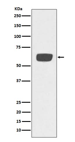 Anti-PLAT/Tpa Rabbit Monoclonal Antibody Boster Bio