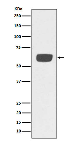 Anti-PLAT/Tpa Rabbit Monoclonal Antibody Boster Bio