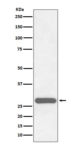 Anti-CITED2 Rabbit Monoclonal Antibody Boster Bio