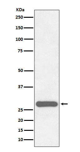 Anti-CITED2 Rabbit Monoclonal Antibody Boster Bio