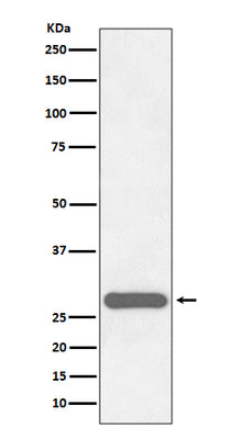 Anti-CITED2 Rabbit Monoclonal Antibody Boster Bio