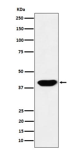 Anti-Islet1 Monoclonal Antibody Boster Bio