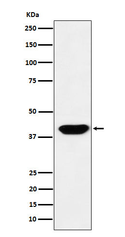 Anti-Islet1 Monoclonal Antibody Boster Bio