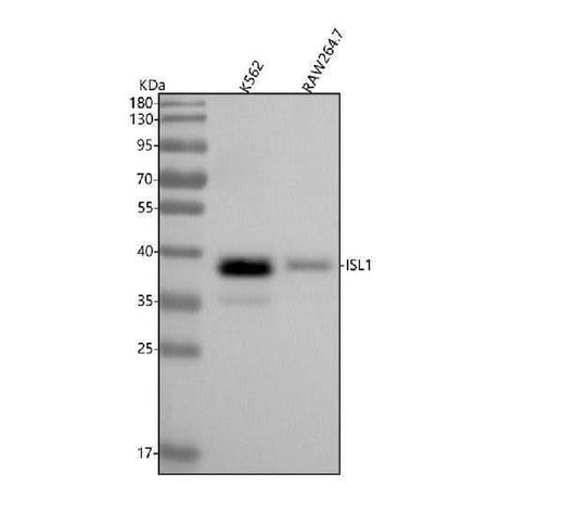 Anti-Islet 1 Rabbit Monoclonal Antibody Boster Bio