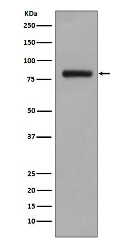 Anti-GOLPH2 Rabbit Monoclonal Antibody Boster Bio