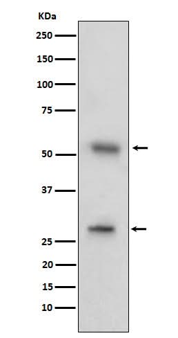 Anti-CD97 Rabbit Monoclonal Antibody Boster Bio