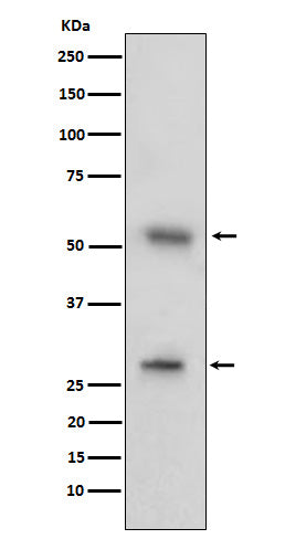 Anti-CD97 Rabbit Monoclonal Antibody Boster Bio