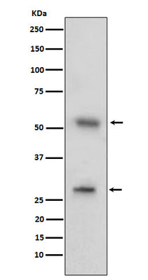 Anti-CD97 Rabbit Monoclonal Antibody Boster Bio