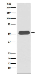 Anti-LSP1 Rabbit Monoclonal Antibody Boster Bio