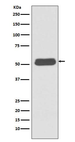 Anti-LSP1 Rabbit Monoclonal Antibody Boster Bio