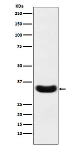 Anti-Scramblase 1 Rabbit Monoclonal Antibody Boster Bio