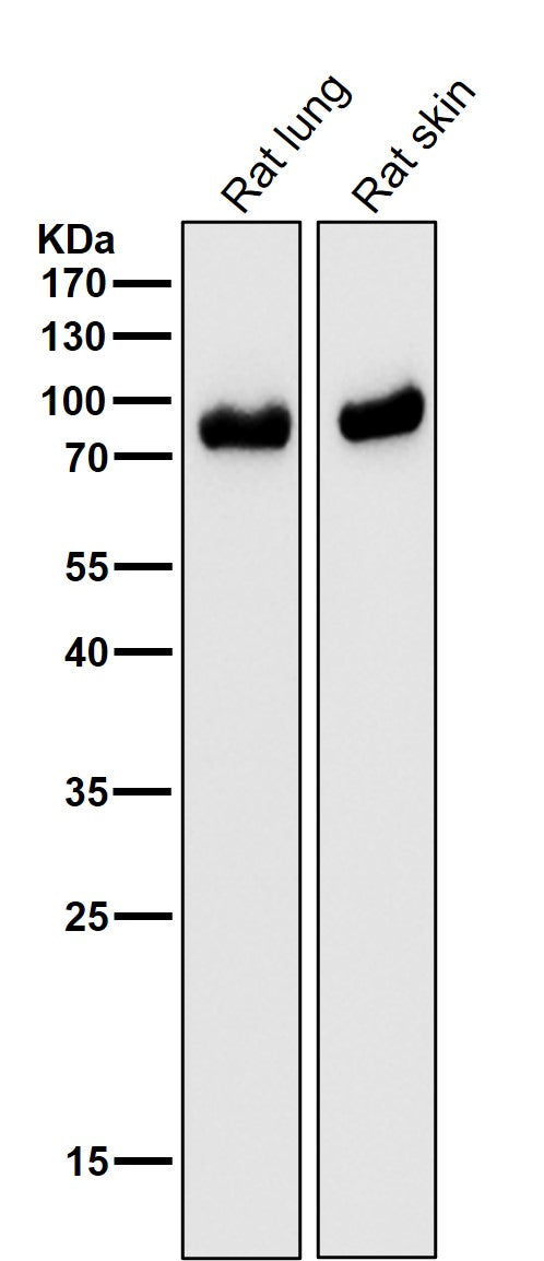Anti-CD105 Rabbit Monoclonal Antibody Boster Bio