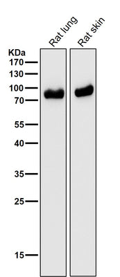 Anti-CD105 Rabbit Monoclonal Antibody Boster Bio