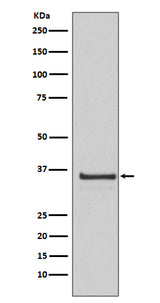 Anti-Cyclin H Rabbit Monoclonal Antibody Boster Bio