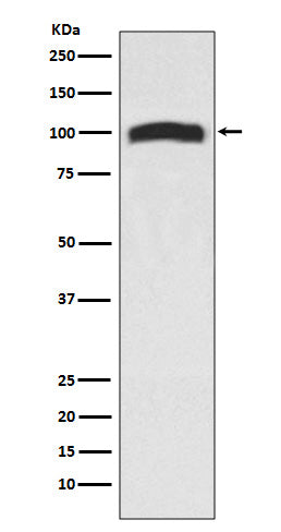 Anti-VAV2 Rabbit Monoclonal Antibody Boster Bio