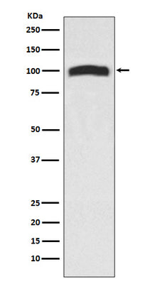 Anti-VAV2 Rabbit Monoclonal Antibody Boster Bio