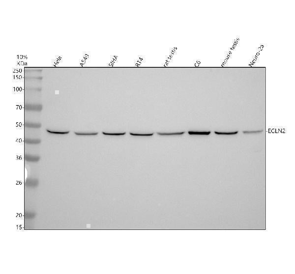 Anti-PHD1/prolyl hydroxylase Rabbit Monoclonal Antibody Boster Bio