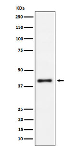 Anti-IL15RA Rabbit Monoclonal Antibody Boster Bio