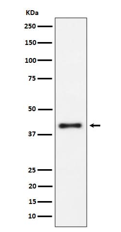 Anti-IL15RA Rabbit Monoclonal Antibody Boster Bio