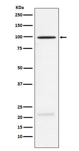 Anti-MAG Rabbit Monoclonal Antibody Boster Bio