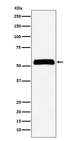 Anti-IMPDH2 Rabbit Monoclonal Antibody Boster Bio