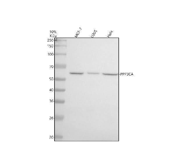 Anti-Calcineurin A Rabbit Monoclonal Antibody Boster Bio
