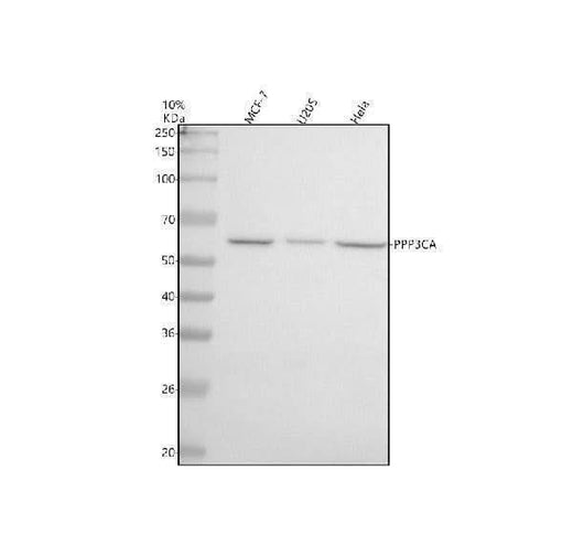 Anti-Calcineurin A Rabbit Monoclonal Antibody Boster Bio