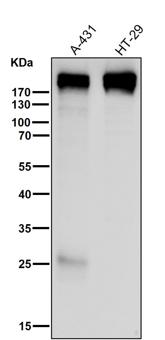 Anti-Collagen XVII Rabbit Monoclonal Antibody Boster Bio