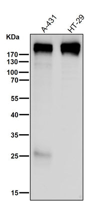 Anti-Collagen XVII Rabbit Monoclonal Antibody Boster Bio