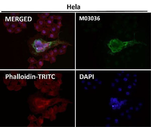 Anti-xCT Rabbit Monoclonal Antibody Boster Bio