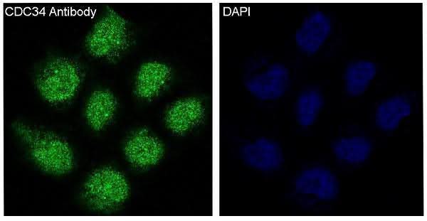 Anti-CDC34/Ubch3 Rabbit Monoclonal Antibody Boster Bio
