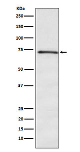 Anti-DOK1 Rabbit Monoclonal Antibody Boster Bio