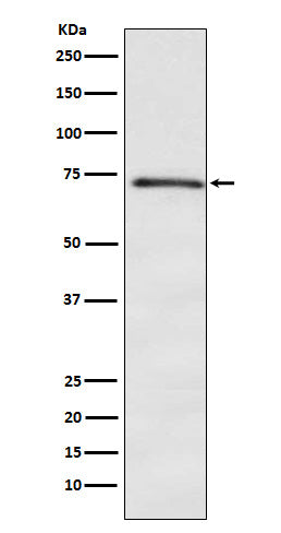 Anti-DOK1 Rabbit Monoclonal Antibody Boster Bio