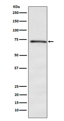 Anti-DOK1 Rabbit Monoclonal Antibody Boster Bio