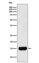 Anti-MSMB Monoclonal Antibody Boster Bio