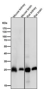 Anti-Calbindin CALB1 Rabbit Monoclonal Antibody Boster Bio