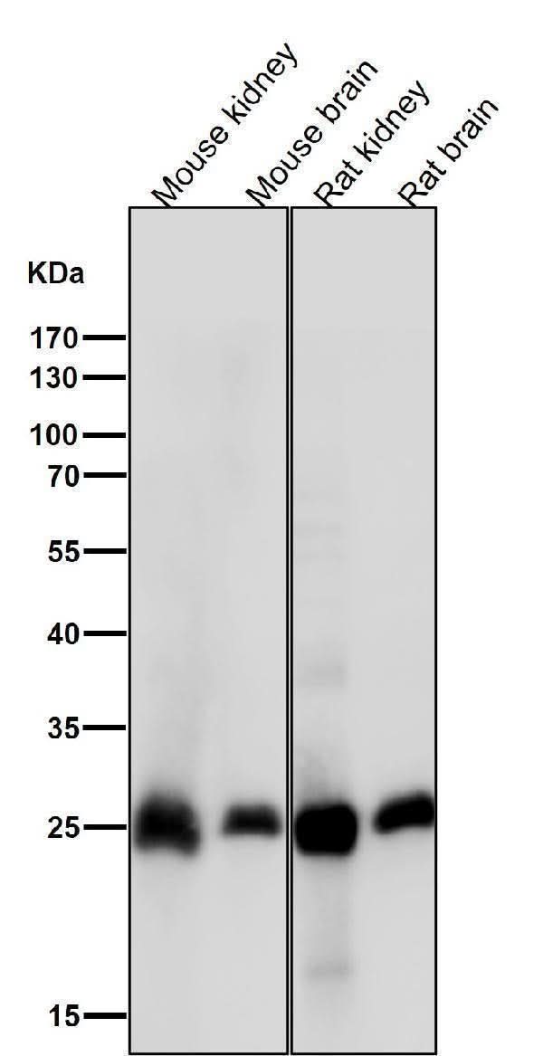 Anti-Calbindin CALB1 Rabbit Monoclonal Antibody Boster Bio