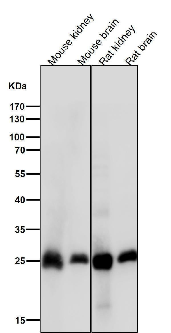 Anti-Calbindin CALB1 Rabbit Monoclonal Antibody Boster Bio