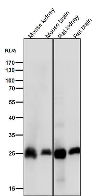 Anti-Calbindin CALB1 Rabbit Monoclonal Antibody Boster Bio