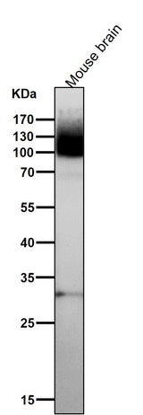 Anti-mGluR1 GRM1 Rabbit Monoclonal Antibody Boster Bio