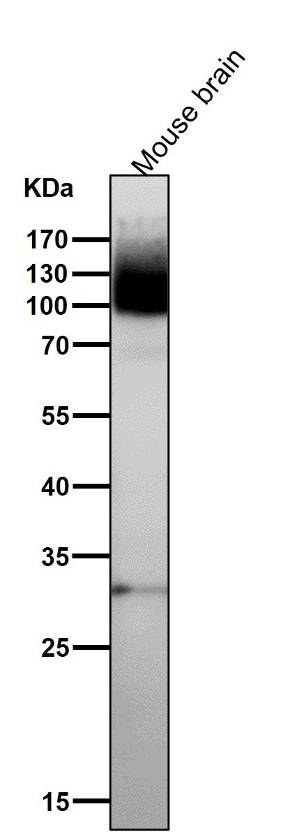 Anti-mGluR1 GRM1 Rabbit Monoclonal Antibody Boster Bio