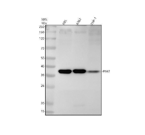 Anti-PIM2 Rabbit Monoclonal Antibody Boster Bio